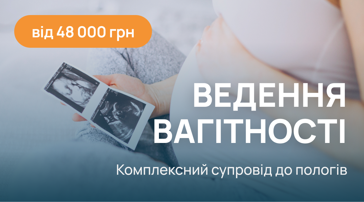 Акция